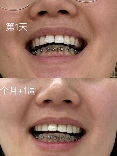 河南郑州赛德阳光口腔（郑州赛德口腔医院）详细的预约挂号方式及流程