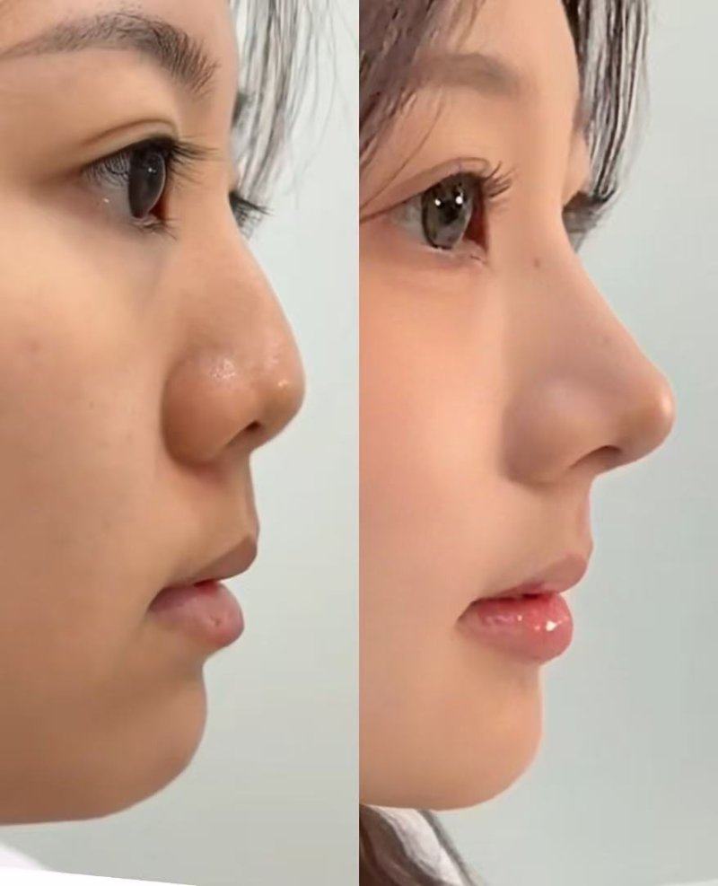 口碑评价及真人实例