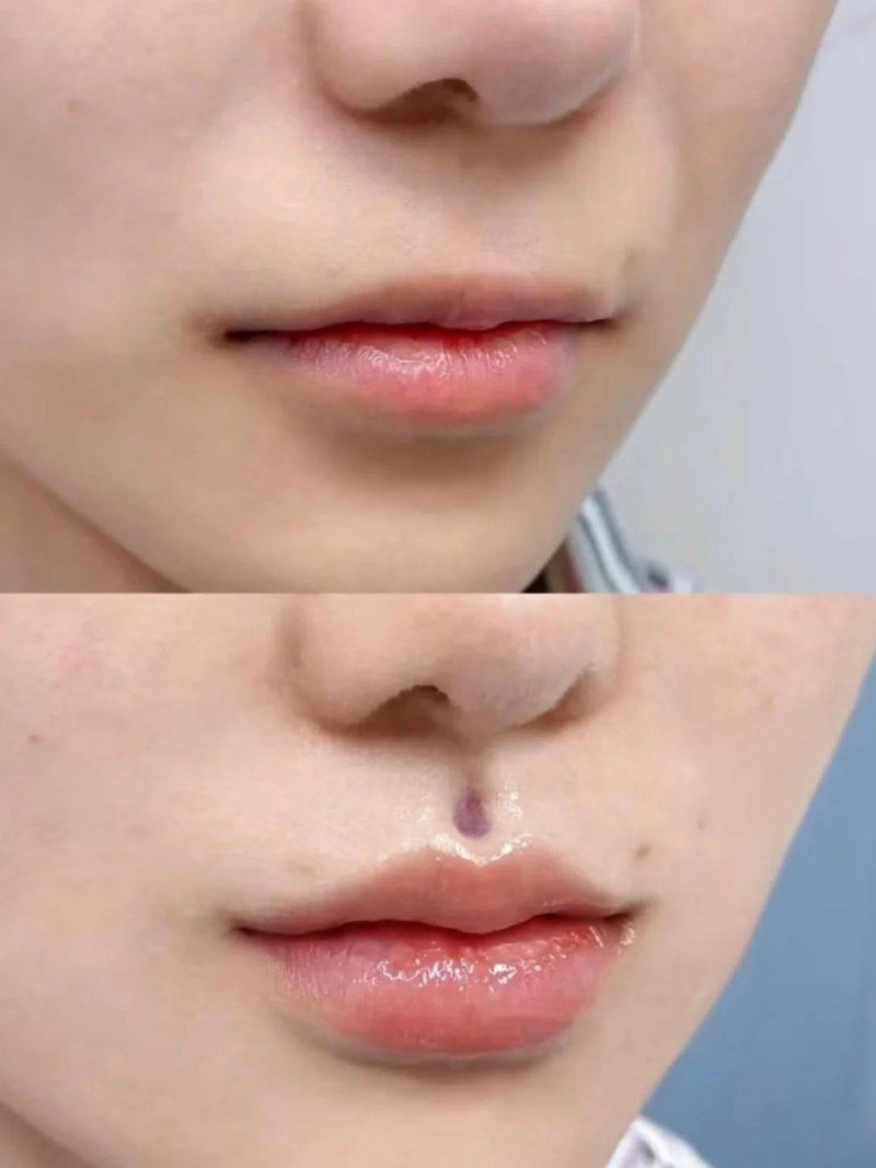 郑州曼蒂整形美容医院收费价格表/收费标准