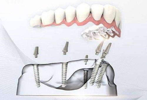 张进城医生预约挂号
