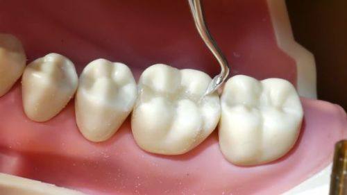 欧忠辉医生擅长项目