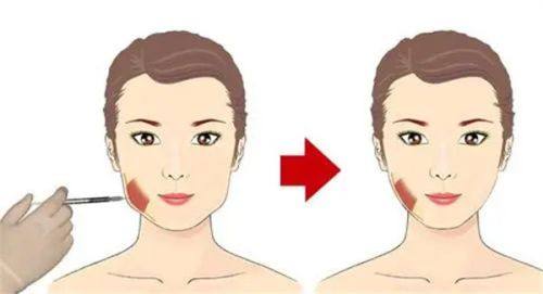 温岭医美佳科技美容城医生团队实力强大及骨干医生简介