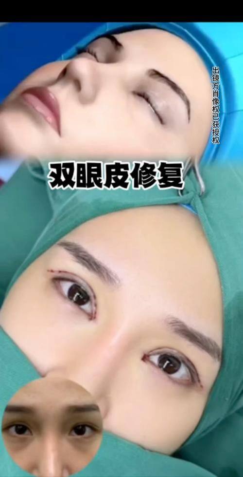 哈尔滨蓝依坊整形医院真人口碑评价怎么样？