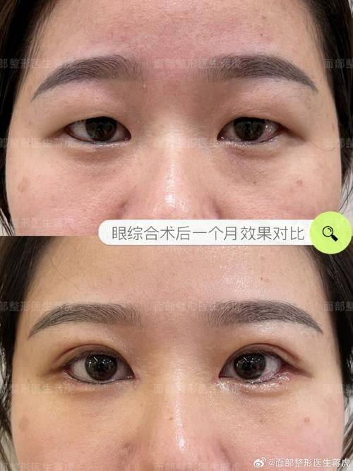 梁雅娜医生价格表