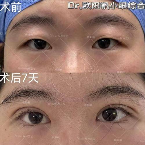 梁雅娜医生口碑评价及真人实例