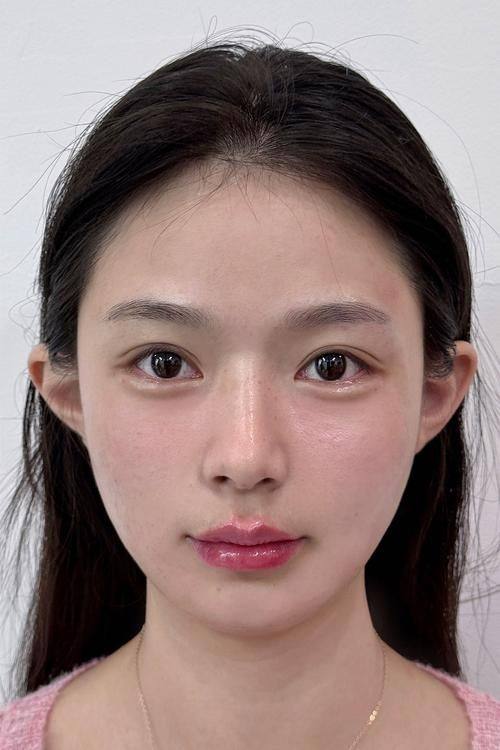 廊坊唯爱可依整形医院是正规医院吗？