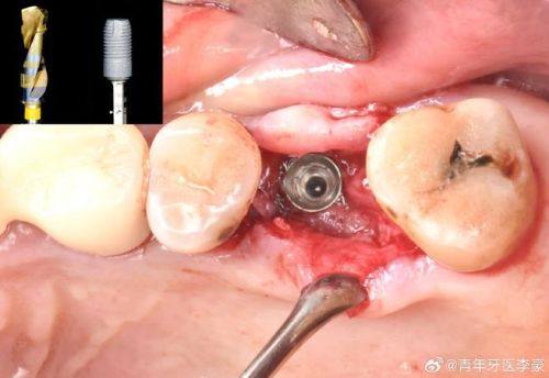 王碧容医生预约挂号