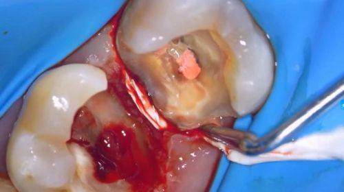 何思铃医生技术优势