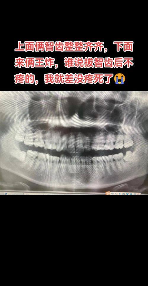 何思铃医生坐诊医院