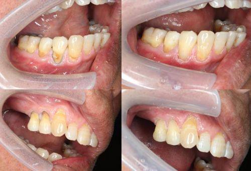 山东淄博沂源张光运口腔诊所医生团队实力强大及骨干医生简介