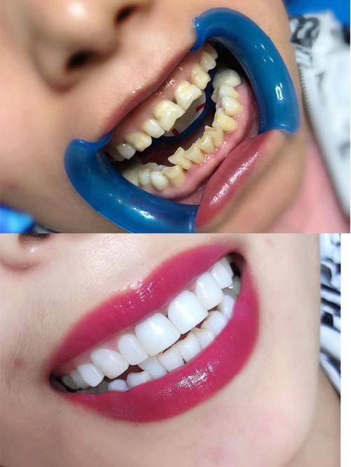 咸阳秦都中恒博康口腔诊所地址电话营业时间