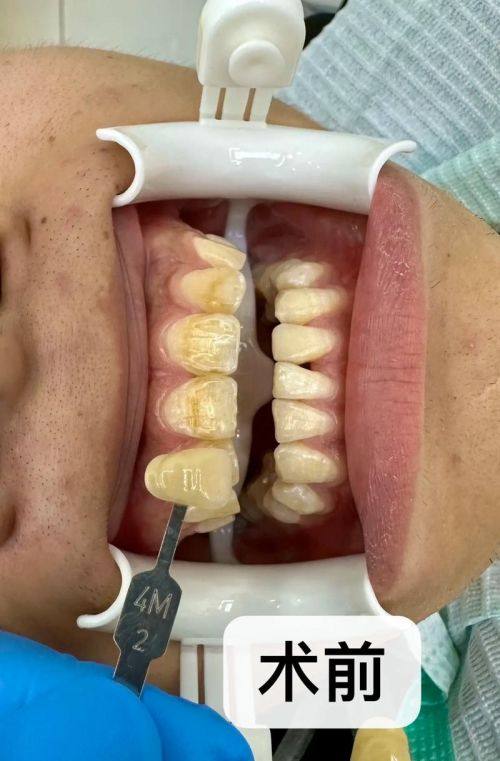 咸阳秦都中恒博康口腔诊所收费价格表/收费标准