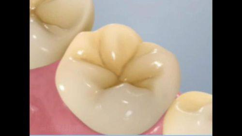 福建莆田君特口腔真人口碑评价怎么样?