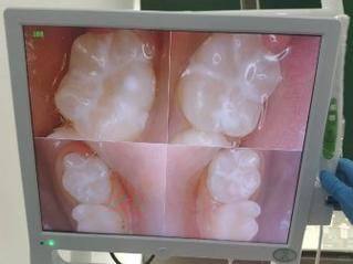 咸阳秦都中恒博康口腔诊所特色项目及技术优势