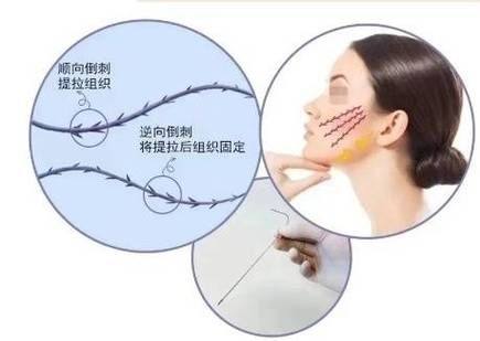 廊坊唯爱可依整形医院真人口碑评价怎么样？