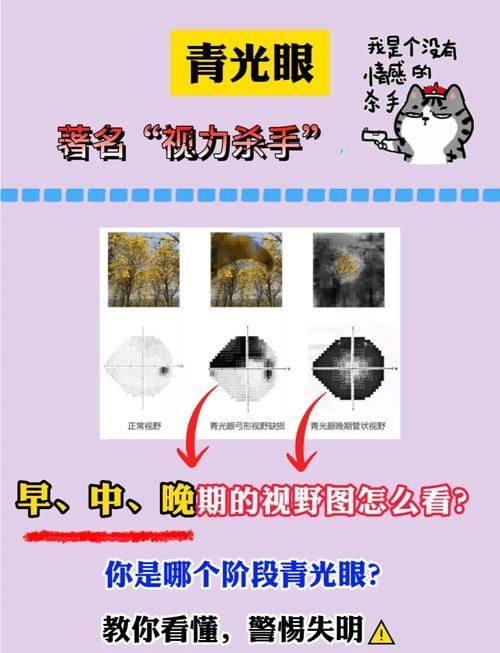 保定市第二医院眼科特色项目及技术优势