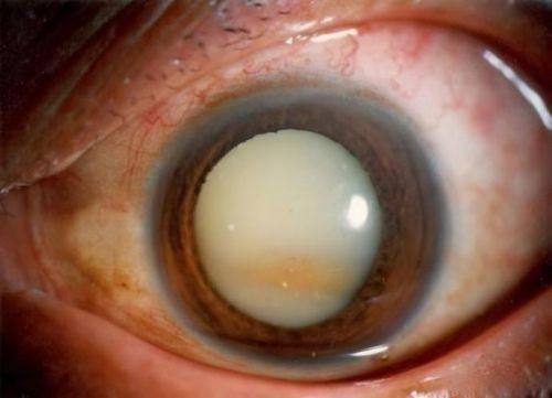 昌吉美尼康眼科医院特色项目及技术优势