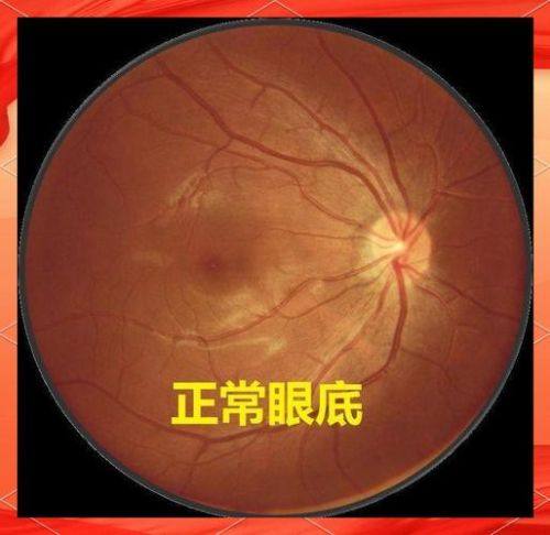 汕头市中 心医院眼科是正规医院吗?