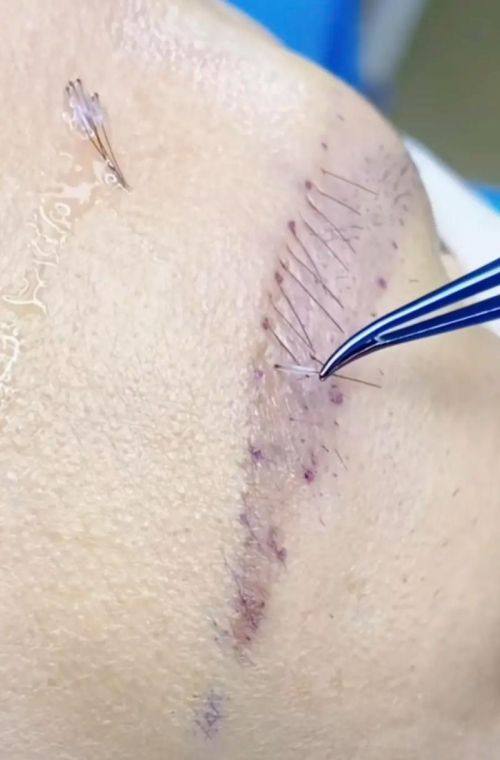 哈尔滨蓝依坊整形医院特色项目及技术优势