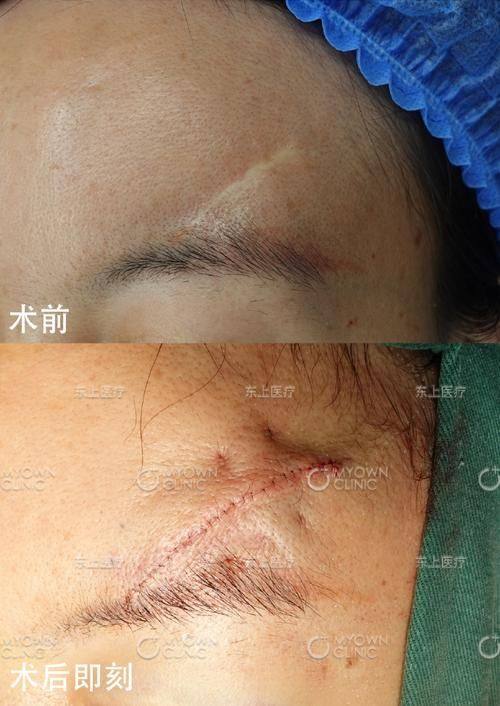 深圳西部烧伤整形医院特色项目及技术优势