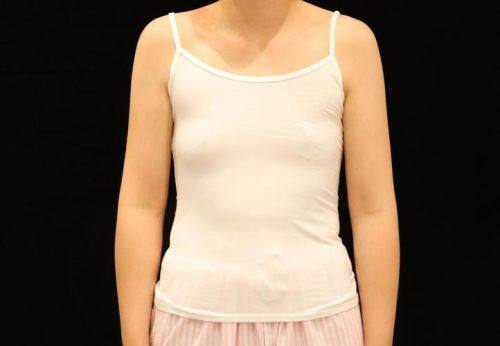 哈尔滨蓝依坊整形医院详细的预约挂号方式及流程