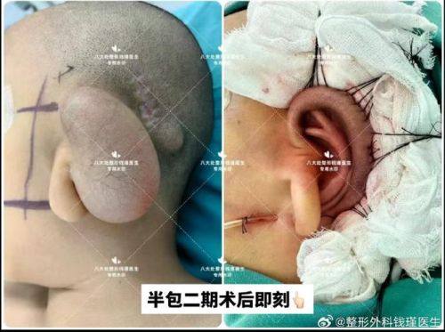 深圳西部烧伤整形医院地址电话营业时间