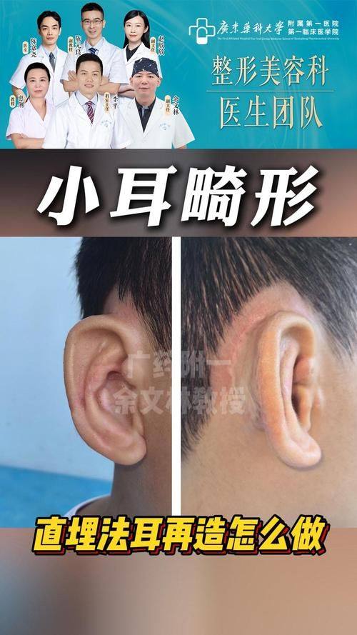 深圳西部烧伤整形医院是正规医院吗?