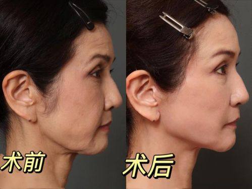 温岭医美佳科技美容城是正规医院吗？