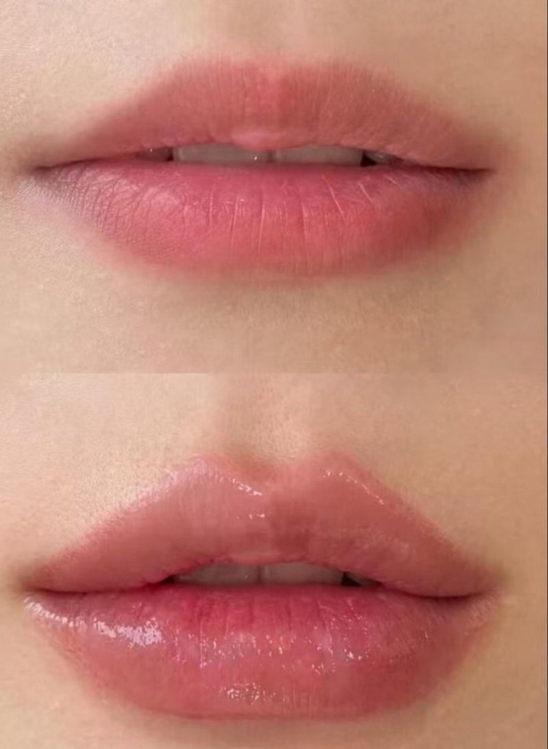 深圳西部烧伤整形医院收费价格表/收费标准