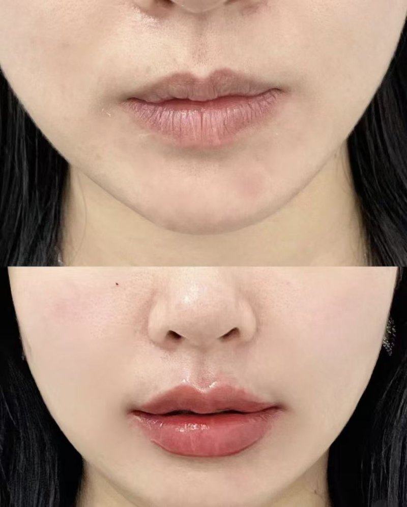 哈尔滨蓝依坊整形医院是正规医院吗？