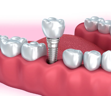 张进城医生价格表