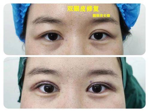 肖文明医生技术优势