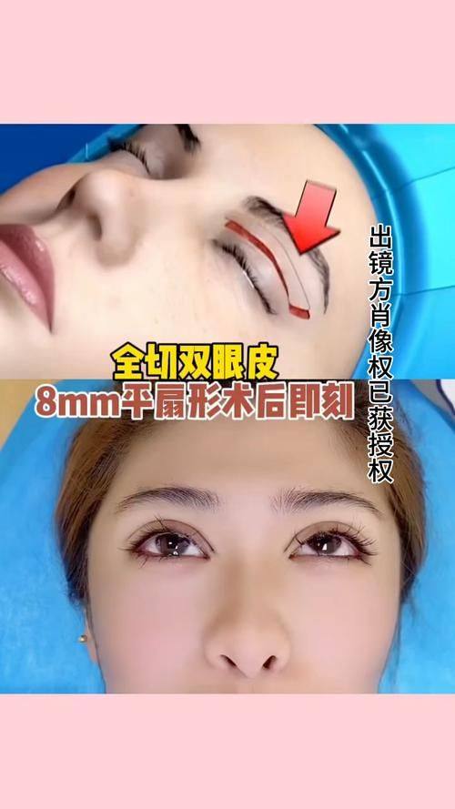 南宁密斯整形医疗美容医院详细的预约挂号方式及流程