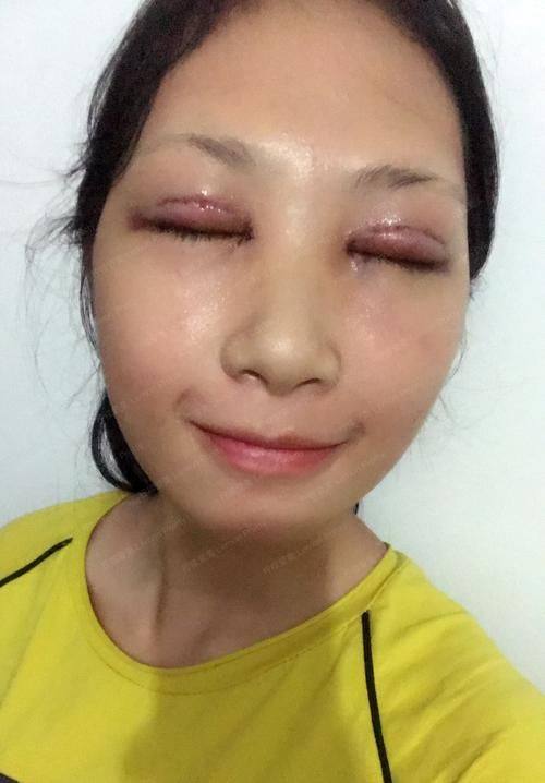 西安伊美尔医疗美容医院详细的预约挂号方式及流程