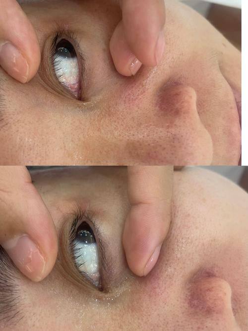 遵义青睐整形美容医院是正规医院吗？