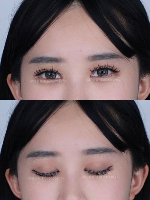 西安伊美尔医疗美容医院特色项目及技术优势