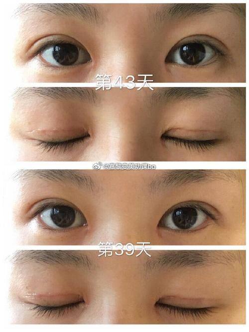 遵义青睐整形美容医院详细的预约挂号方式及流程