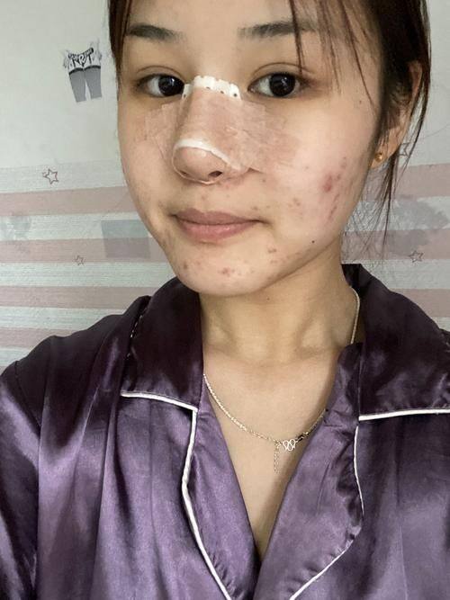 西安伊美尔医疗美容医院真人口碑评价怎么样？