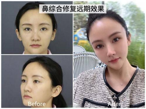 呼和浩特五维医疗美容诊所真人口碑评价怎么样?