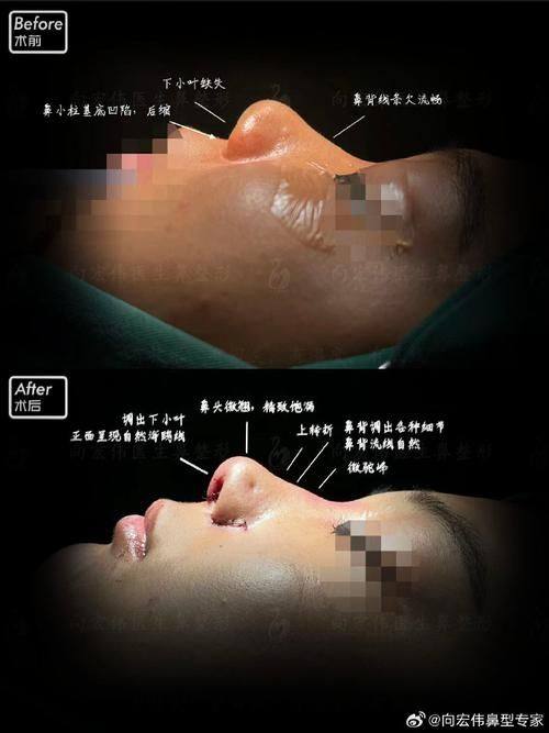 西安伊美尔医疗美容医院是正规医院吗？