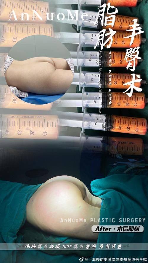 定西薇薇新医学美容门诊部特色项目及技术优势