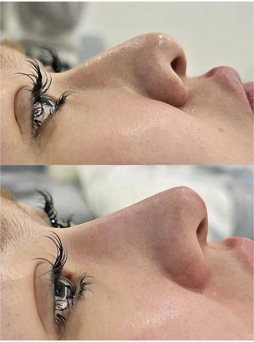 三亚艾美尔医疗美容门诊部是正规医院吗？