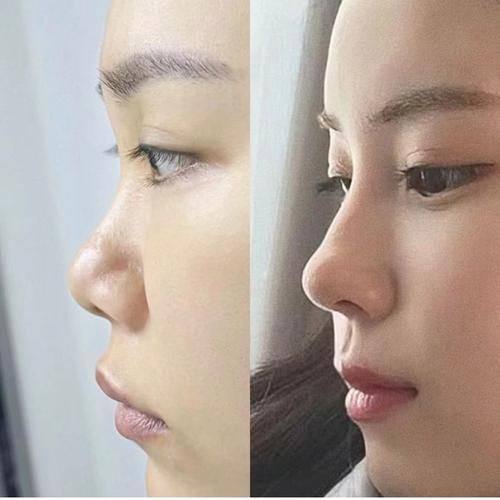 三亚艾美尔医疗美容门诊部真人口碑评价怎么样？