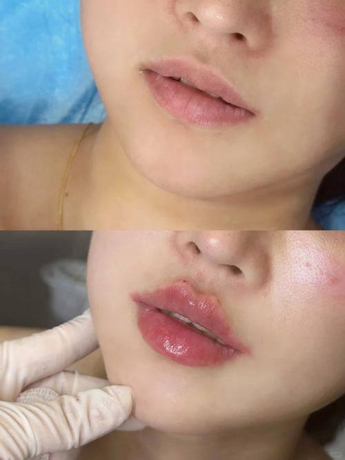 三亚艾美尔医疗美容门诊部详细的预约挂号方式及流程