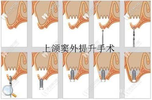 王碧容医生技术优势