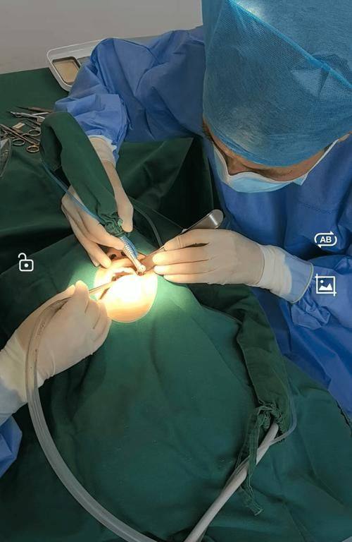 王碧容医生口碑评价及真人实例