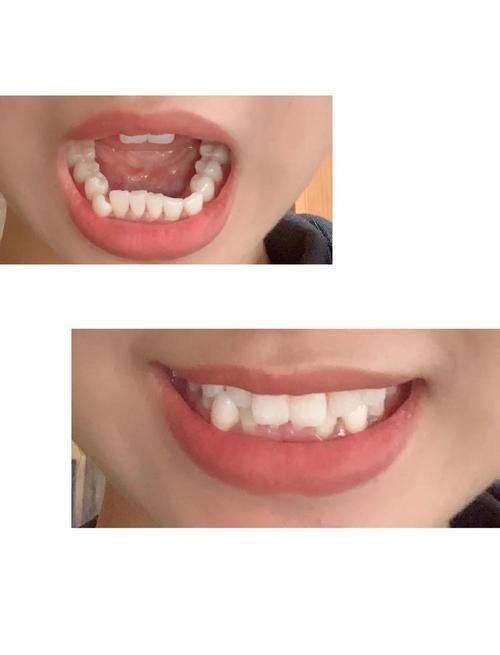 贵阳毕节牙管家口腔（大方机构）真人口碑评价怎么样？