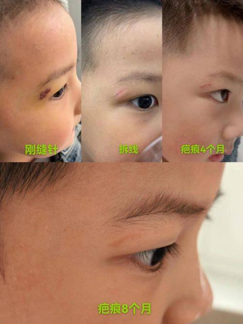 武汉大麦植发医院(原科发源)地址电话营业时间