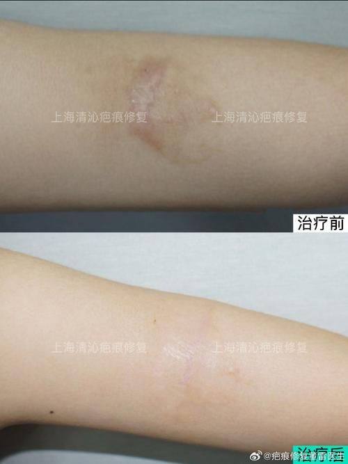 遵义青睐整形美容医院特色项目及技术优势