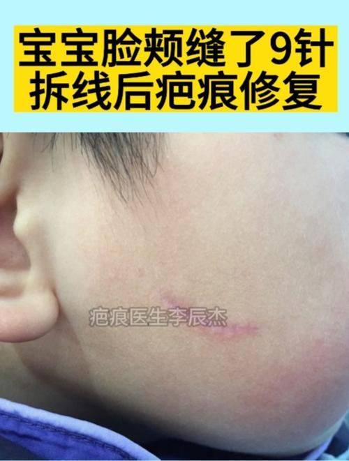 南宁密斯整形医疗美容医院真人口碑评价怎么样？